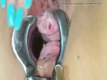 Hucow Annie espéculo chorro